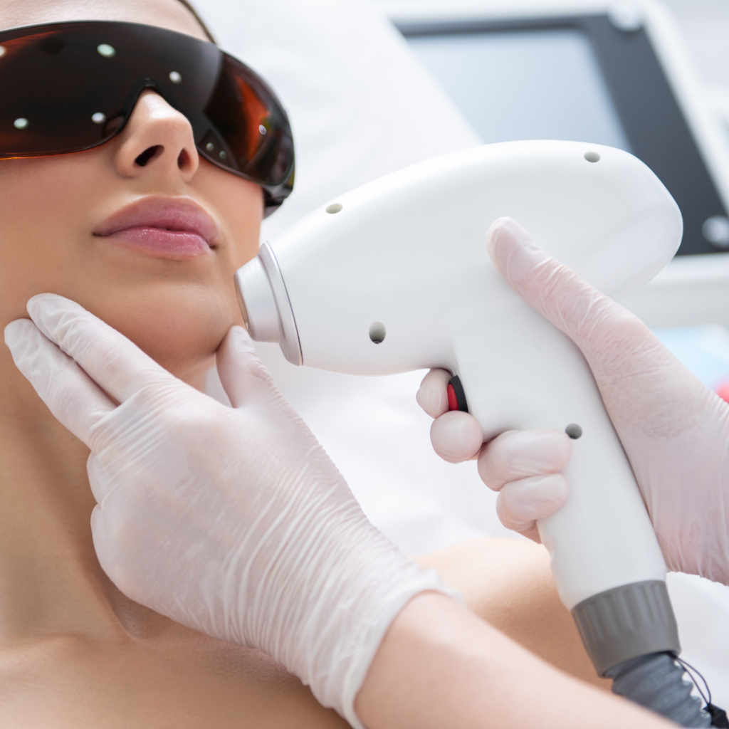 laser hair removal clearwater fl (1)